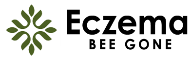 Eczema Bee Gone